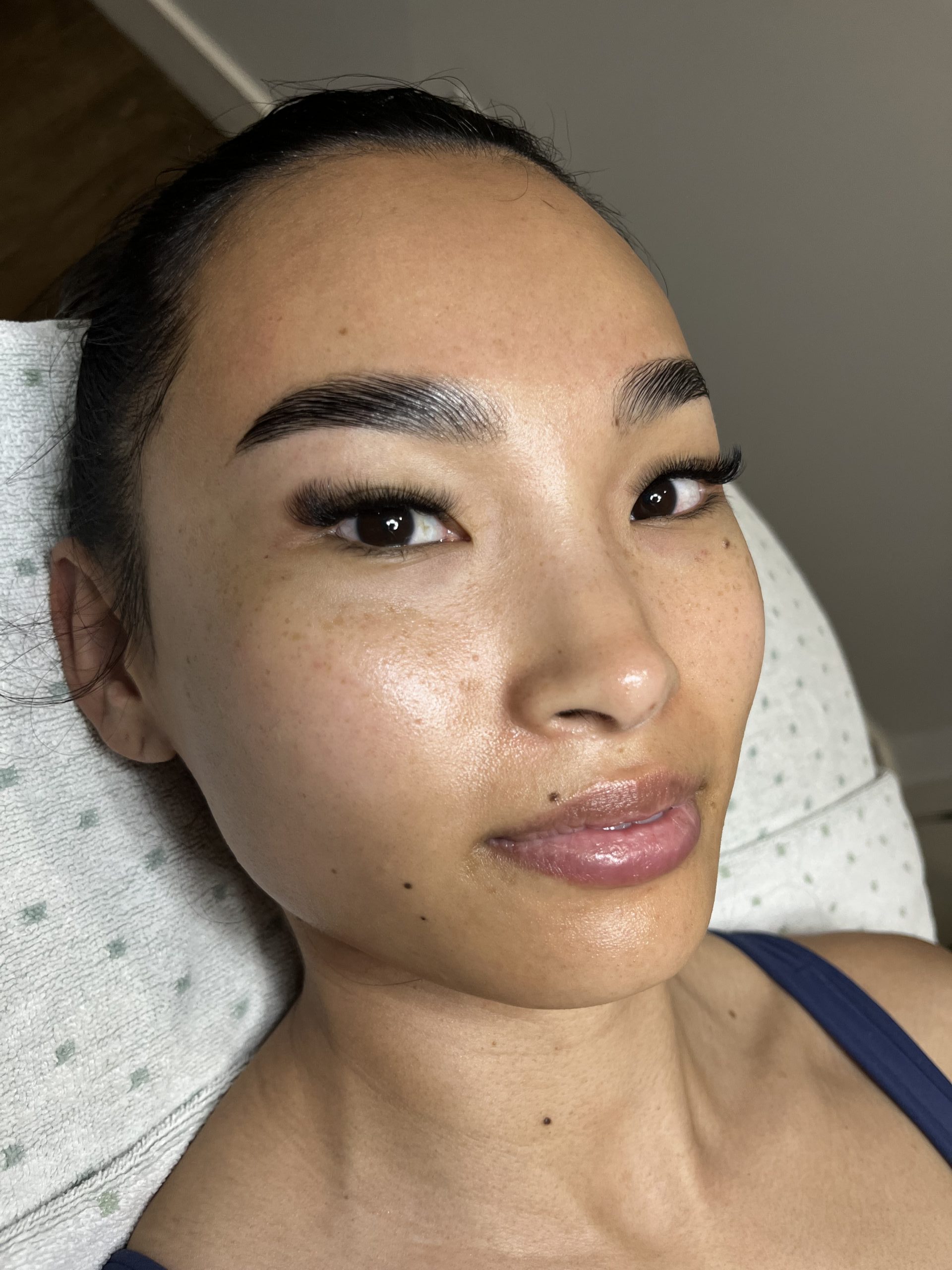 The Skin Method